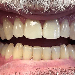 Dr. Rubén Chamorro - Odontología Estética ( Restauramos cualquier sonrisa )